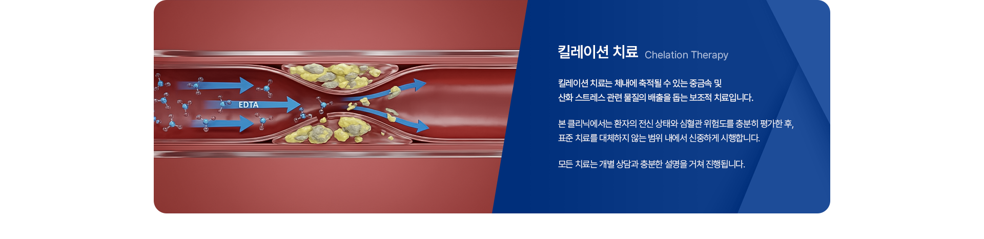 킬레이션 치료 Chelation Therapy 킬레이션 치료는 체네에 축적될 수 있는 중금속 및 산화 스트레스 관련 물질의 배출을 돕는 보조적 치료입니다. 본 클리닉에서는 환자의 전신 상태와 심혈관 위험도를 충분히 평가한 후, 표준 치료를 대체하지 않는 범위 내에서 신중하게 시행합니다. 모든 치료는 개별 상담과 충분한 설명을 거쳐 진행됩니다.